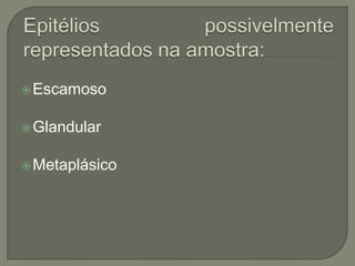 Escamoso
Glandular
Metaplásico
 