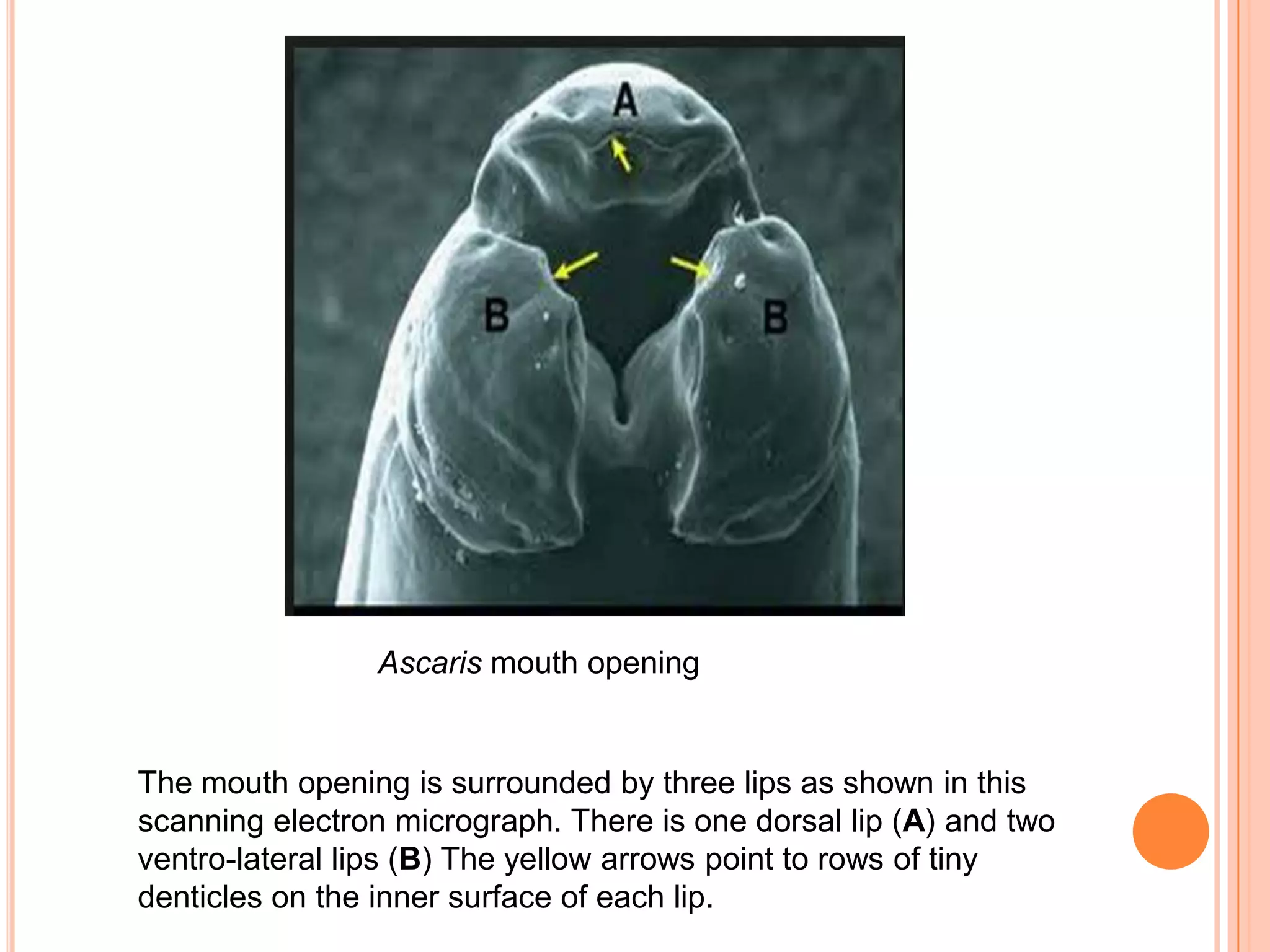 Ascaris mouth opening


The mouth opening is surrounded by three lips as shown in this
scanning electron micrograph. There is one dorsal lip (A) and two
ventro-lateral lips (B) The yellow arrows point to rows of tiny
denticles on the inner surface of each lip.
 