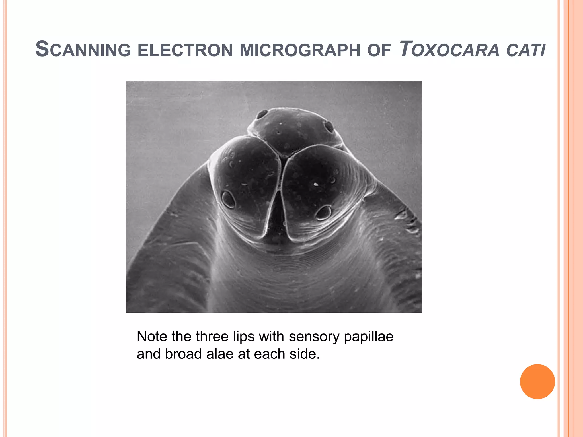 SCANNING ELECTRON MICROGRAPH OF TOXOCARA CATI




        Note the three lips with sensory papillae
        and broad alae at each side.
 