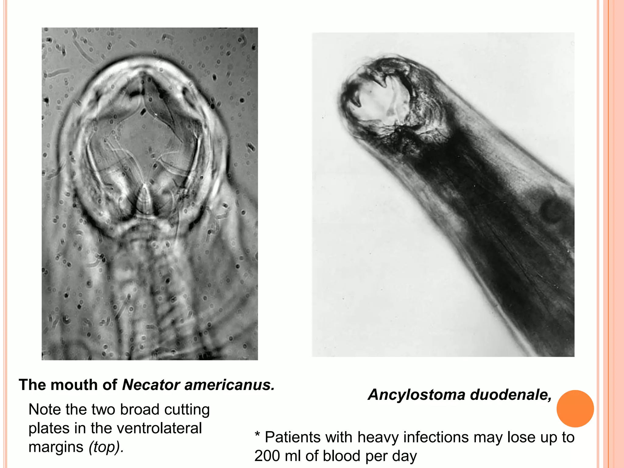 The mouth of Necator americanus.
                                               Ancylostoma duodenale,
 Note the two broad cutting
 plates in the ventrolateral
                               * Patients with heavy infections may lose up to
 margins (top).
                               200 ml of blood per day
 