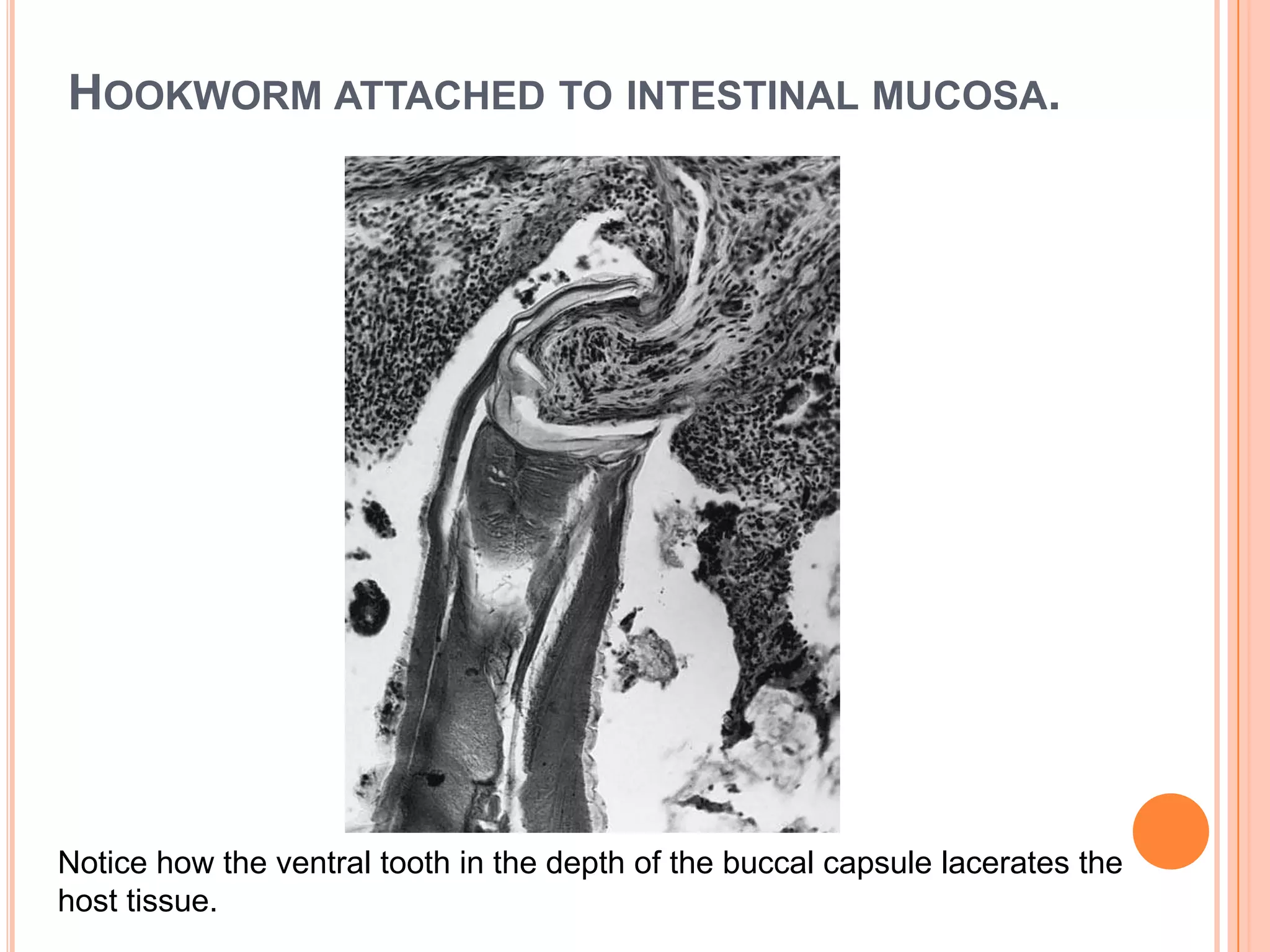 HOOKWORM ATTACHED TO INTESTINAL MUCOSA.




Notice how the ventral tooth in the depth of the buccal capsule lacerates the
host tissue.
 