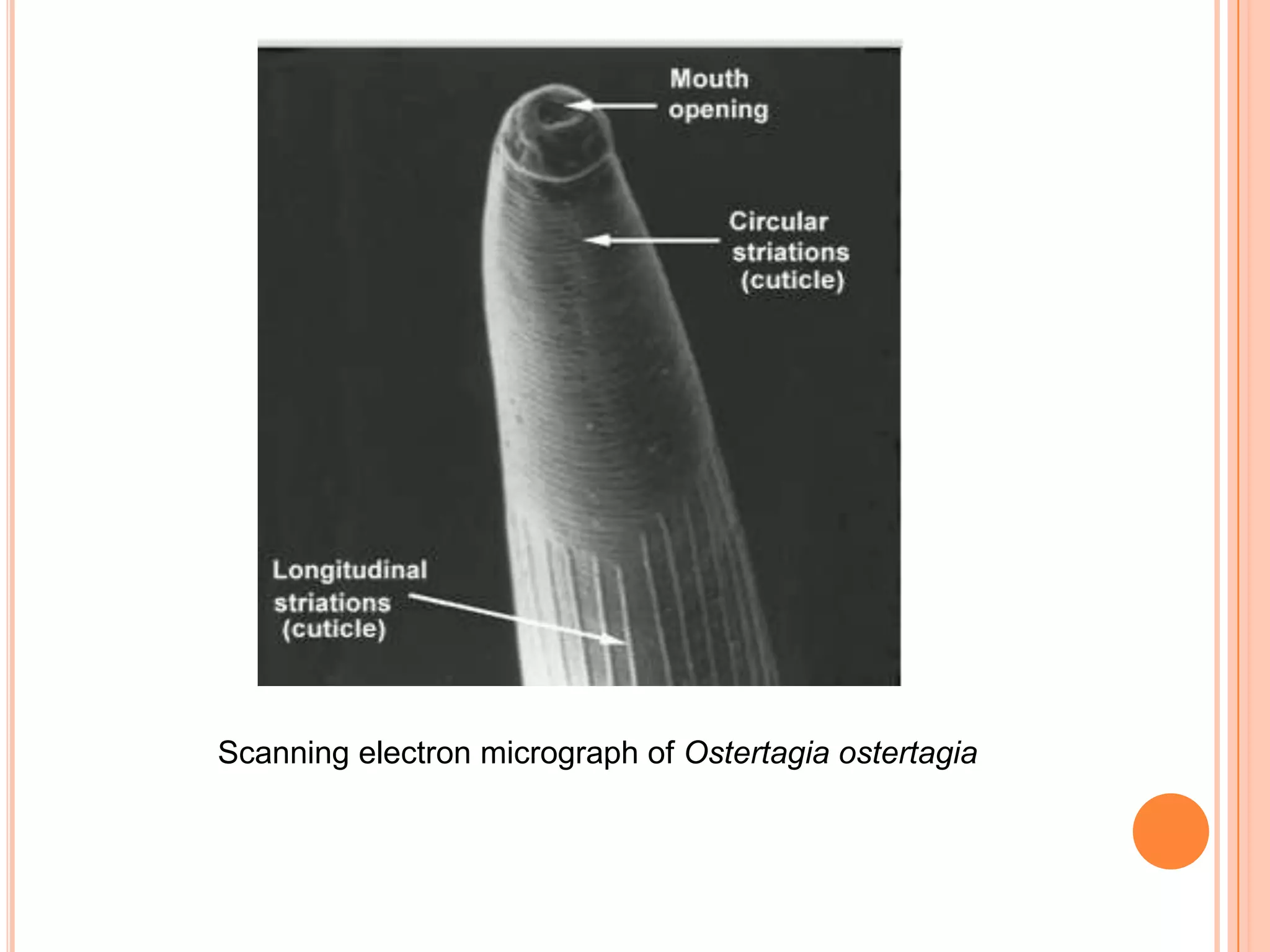 Scanning electron micrograph of Ostertagia ostertagia
 