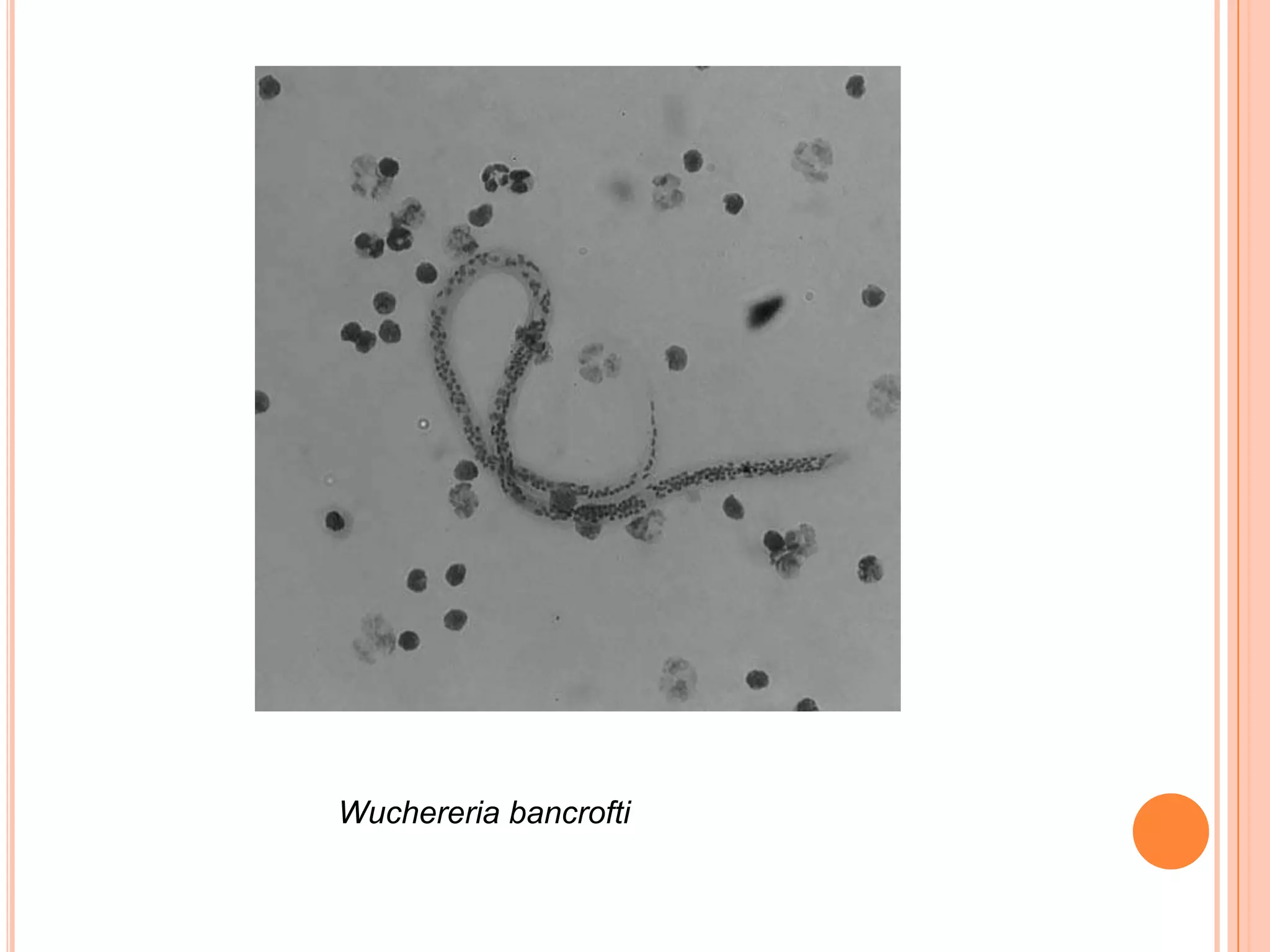 Wuchereria bancrofti
 