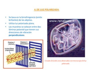 • Se basa en la birrefringencia (emite
brillantez) de los objetos.
• Utiliza luz polarizada plana.
• Las muestras se colocan entre dos
láminas polaroid que tienen sus
direcciones de vibración
perpendiculares
Cristales deácido uricoobservados con microscopio deluz
polarizada
4. DE LUZ POLARIZADA:
.
 