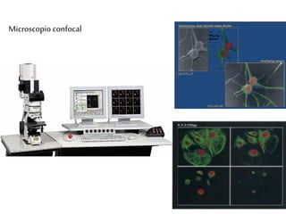 Microscopio confocal
 