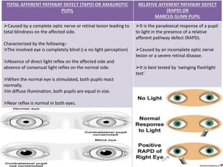 Examination of pupil by pushkar dhir | PPTX