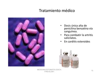 MEDICINA ESTOMATOLOGICA -
ITREVEJOR -
15
Tratamiento médico
• Dosis única alta de
penicilina benzatina vía
sanguínea.
• Para combatir la artritis
salicilatos.
• En carditis esteroides
 