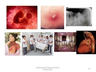 MEDICINA ESTOMATOLOGICA -
ITREVEJOR -
24
 