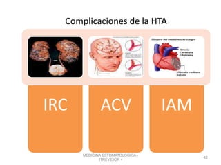 Complicaciones de la HTA
IRC ACV IAM
MEDICINA ESTOMATOLOGICA -
ITREVEJOR -
42
 