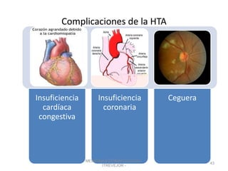 Complicaciones de la HTA
Insuficiencia
cardíaca
congestiva
Insuficiencia
coronaria
Ceguera
MEDICINA ESTOMATOLOGICA -
ITREVEJOR -
43
 