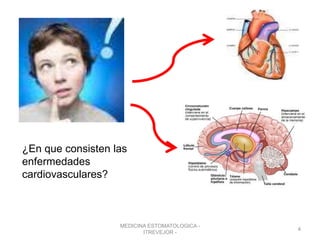 MEDICINA ESTOMATOLOGICA -
ITREVEJOR -
4
¿En que consisten las
enfermedades
cardiovasculares?
 