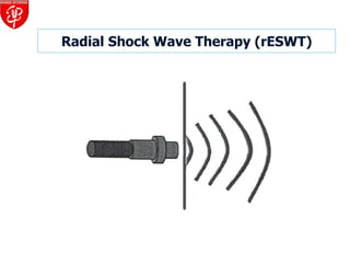 Radial Shock Wave Therapy (rESWT) 