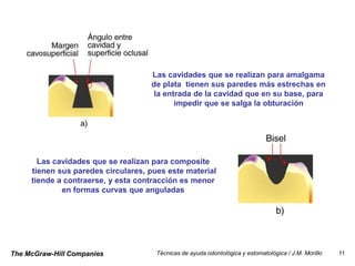 Las cavidades que se realizan para amalgama
                                    de plata tienen sus paredes más estrechas en
                                     la entrada de la cavidad que en su base, para
                                           impedir que se salga la obturación




       Las cavidades que se realizan para composite
     tienen sus paredes circulares, pues este material
     tiende a contraerse, y esta contracción es menor
             en formas curvas que anguladas




The McGraw-Hill Companies             Técnicas de ayuda odontológica y estomatológica / J.M. Morillo   11
 
