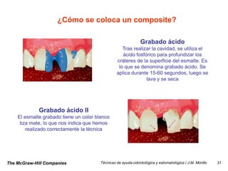 ¿Cómo se coloca un composite?

                                                               Grabado ácido
                                                    Tras realizar la cavidad, se utiliza el
                                                    ácido fosfórico para profundizar los
                                                 cráteres de la superficie del esmalte. Es
                                                  lo que se denomina grabado ácido. Se
                                                 aplica durante 15-60 segundos, luego se
                                                               lava y se seca




             Grabado ácido II
    El esmalte grabado tiene un color blanco
     tiza mate, lo que nos indica que hemos
        realizado correctamente la técnica




The McGraw-Hill Companies               Técnicas de ayuda odontológica y estomatológica / J.M. Morillo   31
 