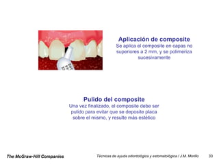Aplicación de composite
                                                   Se aplica el composite en capas no
                                                   superiores a 2 mm, y se polimeriza
                                                             sucesivamente




                                  Pulido del composite
                            Una vez finalizado, el composite debe ser
                             pulido para evitar que se deposite placa
                              sobre el mismo, y resulte más estético




The McGraw-Hill Companies               Técnicas de ayuda odontológica y estomatológica / J.M. Morillo   33
 