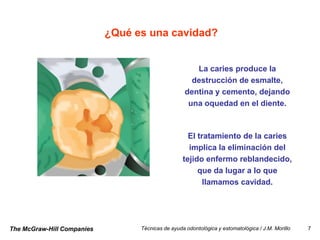 ¿Qué es una cavidad?


                                                       La caries produce la
                                                      destrucción de esmalte,
                                                    dentina y cemento, dejando
                                                     una oquedad en el diente.



                                                     El tratamiento de la caries
                                                     implica la eliminación del
                                                   tejido enfermo reblandecido,
                                                        que da lugar a lo que
                                                          llamamos cavidad.




The McGraw-Hill Companies         Técnicas de ayuda odontológica y estomatológica / J.M. Morillo   7
 