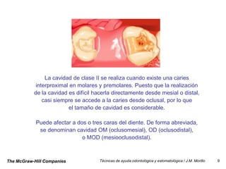 La cavidad de clase II se realiza cuando existe una caries
            interproximal en molares y premolares. Puesto que la realización
           de la cavidad es difícil hacerla directamente desde mesial o distal,
               casi siempre se accede a la caries desde oclusal, por lo que
                         el tamaño de cavidad es considerable.

            Puede afectar a dos o tres caras del diente. De forma abreviada,
             se denominan cavidad OM (oclusomesial), OD (oclusodistal),
                              o MOD (mesiooclusodistal).



The McGraw-Hill Companies            Técnicas de ayuda odontológica y estomatológica / J.M. Morillo   9
 
