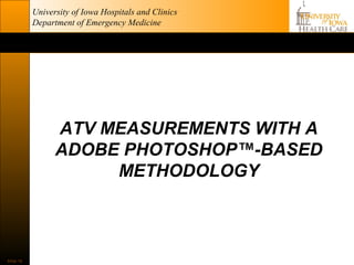 University of Iowa Hospitals and Clinics
           Department of Emergency Medicine




                 ATV MEASUREMENTS WITH A
                 ADOBE PHOTOSHOP™-BASED
                      METHODOLOGY



Slide 16
 