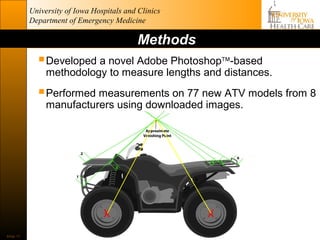 University of Iowa Hospitals and Clinics
           Department of Emergency Medicine

                                            Methods
              Developed a novel Adobe Photoshop™-based
                methodology to measure lengths and distances.

              Performed measurements on 77 new ATV models from 8
                manufacturers using downloaded images.




                                                      6




                                 X                        X
Slide 17
 