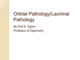 Orbital Pathology/Lacrimal
Pathology
By Prof E. Oghre
Professor of Optometry
 