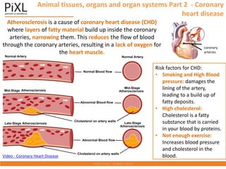Animal tissues, organs and organ systems Part 2 - Coronary
heart disease
Atherosclerosis is a cause of coronary heart disease (CHD)
where layers of fatty material build up inside the coronary
arteries, narrowing them. This reduces the flow of blood
through the coronary arteries, resulting in a lack of oxygen for
the heart muscle.
coronary
arteries
Risk factors for CHD:
• Smoking and High Blood
pressure: damages the
lining of the artery,
leading to a build up of
fatty deposits.
• High cholesterol:
Cholesterol is a fatty
substance that is carried
in your blood by proteins.
• Not enough exercise:
Increases blood pressure
and cholesterol in the
blood.
Video - Coronary Heart Disease
 
