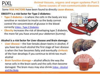 Some RISK FACTORS have been found to directly cause disease.
Animal tissues, organs and organ systems Part 3
- Some causes of non-communicable diseases
OBESITY is a risk factor for Type 2 diabetes:
• Type 2 diabetes – is where the cells in the body are less
sensitive or resistant to insulin so the body cannot
control the concentration of glucose in the blood
correctly Video - Type 2 Diabetes
• Obesity increases the risk of developing type 2 diabetes,
the more fat you have around your abdomen (tummy)
Alcohol is a risk factor for Liver disease and Brain damage:
• Liver disease – the liver breaks down toxins in alcohol, if
you have too much alcohol the first stage of liver disease
is when the liver becomes fatty and eventually cirrhosis
of the liver develops if you continue to drink too much
alcohol
• Brain function damage – alcohol affects the way the
nerve cells in the brain work and the cells then become
damaged. The brain mass may also shrink Video - Alcohol
and the Body
 