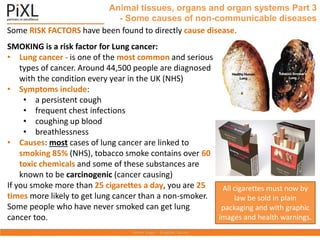 Some RISK FACTORS have been found to directly cause disease.
Animal tissues, organs and organ systems Part 3
- Some causes of non-communicable diseases
SMOKING is a risk factor for Lung cancer:
• Lung cancer - is one of the most common and serious
types of cancer. Around 44,500 people are diagnosed
with the condition every year in the UK (NHS)
• Symptoms include:
• a persistent cough
• frequent chest infections
• coughing up blood
• breathlessness
• Causes: most cases of lung cancer are linked to
smoking 85% (NHS), tobacco smoke contains over 60
toxic chemicals and some of these substances are
known to be carcinogenic (cancer causing)
If you smoke more than 25 cigarettes a day, you are 25
times more likely to get lung cancer than a non-smoker.
Some people who have never smoked can get lung
cancer too.
All cigarettes must now by
law be sold in plain
packaging and with graphic
images and health warnings.
 