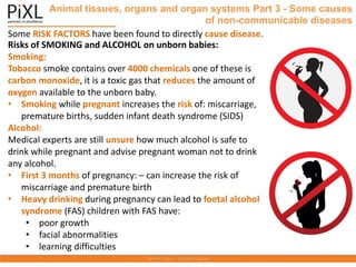 Some RISK FACTORS have been found to directly cause disease.
Animal tissues, organs and organ systems Part 3 - Some causes
of non-communicable diseases
Risks of SMOKING and ALCOHOL on unborn babies:
Smoking:
Tobacco smoke contains over 4000 chemicals one of these is
carbon monoxide, it is a toxic gas that reduces the amount of
oxygen available to the unborn baby.
• Smoking while pregnant increases the risk of: miscarriage,
premature births, sudden infant death syndrome (SIDS)
Alcohol:
Medical experts are still unsure how much alcohol is safe to
drink while pregnant and advise pregnant woman not to drink
any alcohol.
• First 3 months of pregnancy: – can increase the risk of
miscarriage and premature birth
• Heavy drinking during pregnancy can lead to foetal alcohol
syndrome (FAS) children with FAS have:
• poor growth
• facial abnormalities
• learning difficulties
 
