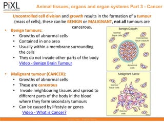 Animal tissues, organs and organ systems Part 3 - Cancer
Uncontrolled cell division and growth results in the formation of a tumour
(mass of cells), these can be BENIGN or MALIGNANT, not all tumours are
cancerous.
• Benign tumours:
• Growths of abnormal cells
• Contained in one area
• Usually within a membrane surrounding
the cells
• They do not invade other parts of the body
Video - Benign Brain Tumour
• Malignant tumour (CANCER):
• Growths of abnormal cells
• These are cancerous
• Invade neighbouring tissues and spread to
different parts of the body in the blood
where they form secondary tumours
• Can be caused by lifestyle or genes
Video - What is Cancer?
 