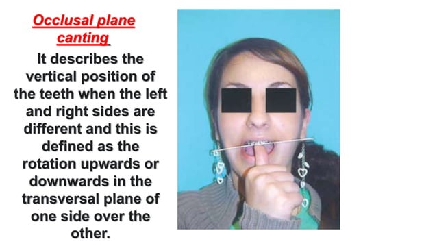 Disgiuntore Con Rialzi Occlusali - Los Ortodonzia - Foto 7