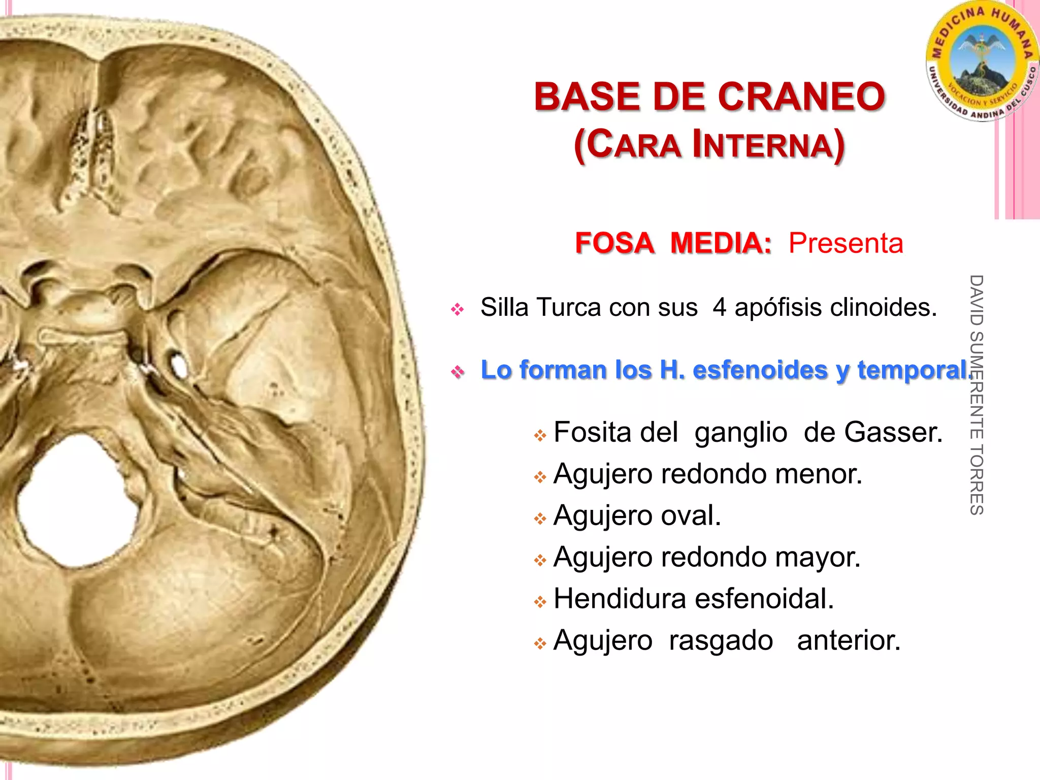 Osteología General De La Cabeza Pptx