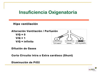 Insuficiencia Oxigenatoria

 Hipo ventilación

Alteración Ventilación / Perfusión
   V/Q = 0
   V/Q = 1
   V/Q = infinito

Difusión de Gases

Corto Circuito Intra o Extra cardiaco (Shunt)

Disminución de PiO2
 