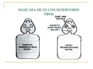 MASCARA DE O2 CON RESERVORIO
           TIPOS
 