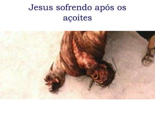 Jesus sofrendo após os
        açoites
 