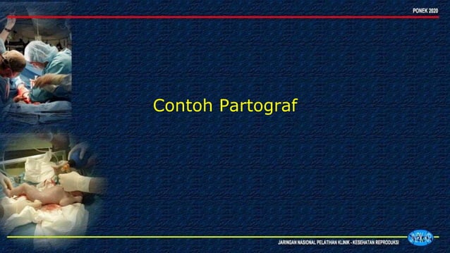 2Pengisian PARTOGRAF dalam pemantauan persaliananppt.pptx