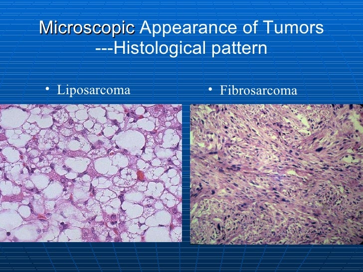 2 pathological diagnosis of cancer