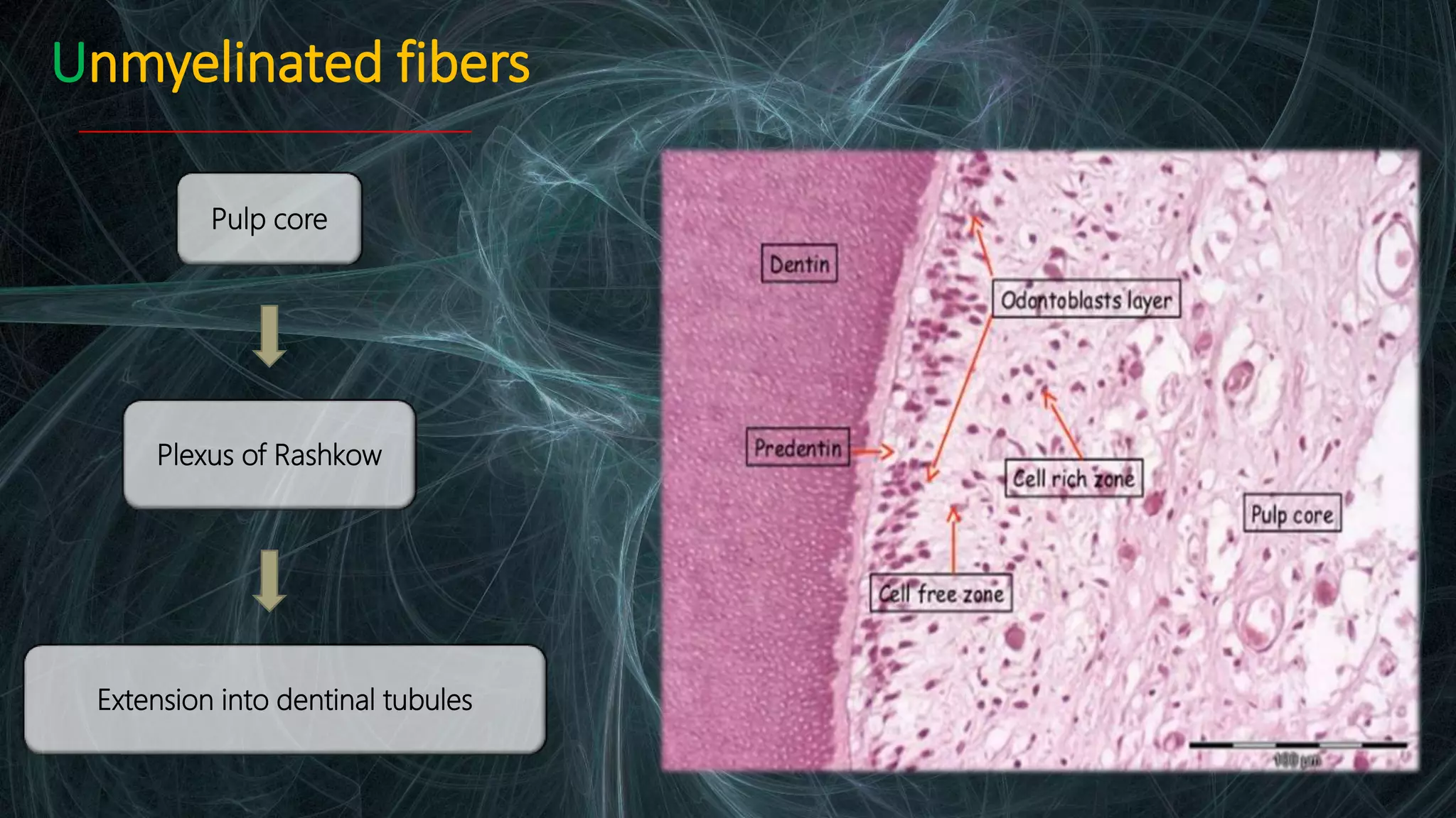 Dental pain (Irreversible pulpitis: Pathophysiology) | PPTX