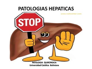 PATOLOGIAS HEPATICAS




      PATOLOGIA QUIRÚRGICA
    Universidad Católica Boliviana
 