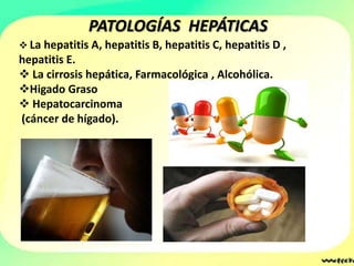 PATOLOGÍAS HEPÁTICAS
 La hepatitis A, hepatitis B, hepatitis C, hepatitis D ,
hepatitis E.
 La cirrosis hepática, Farmacológica , Alcohólica.
Higado Graso
 Hepatocarcinoma
(cáncer de hígado).
 