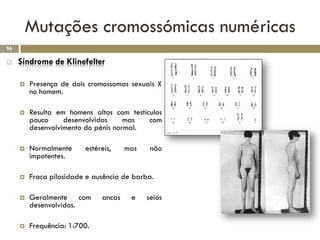Mutações cromossómicas numéricas
96

    Síndrome de Klinefelter

        Presença de dois cromossomas sexuais X
         no homem.

        Resulta em homens altos com testículos
         pouco     desenvolvidos     mas   com
         desenvolvimento do pénis normal.

        Normalmente     estéreis,    mas    não
         impotentes.

        Fraca pilosidade e ausência de barba.

        Geralmente com       ancas    e    seios
         desenvolvidos.

        Frequência: 1:700.
 