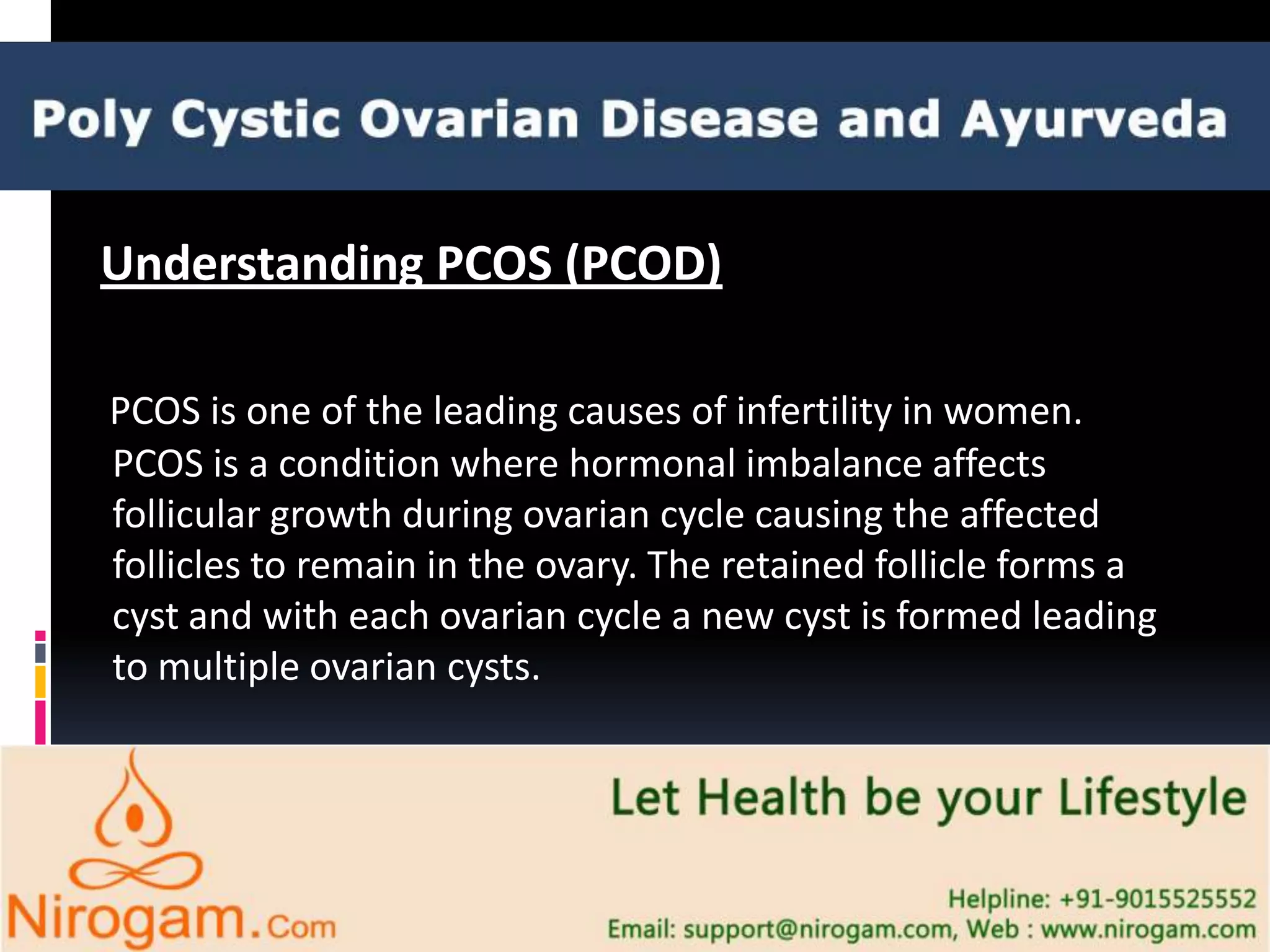 View of Poly Cystic Ovarian Disease and Ayurveda | PPTX