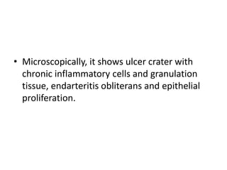 • Microscopically, it shows ulcer crater with
chronic inflammatory cells and granulation
tissue, endarteritis obliterans and epithelial
proliferation.
 