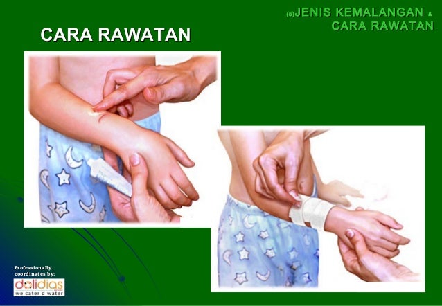 Cara Merawat Luka Kecil Jom klik artikel ini untuk tahu Cara Merawat Luka Kecil Jom klik artikel ini untuk tahu