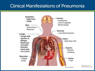  CLINICAL MANIFESTATIONS :
 
