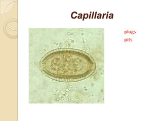 Capillaria
plugs
 pits
 