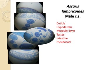 Ascaris
lumbricoides
Male c.s.
Cuticle
Hypodermis
Muscular layer
Testes
Intestine
Pseudocoel
 
