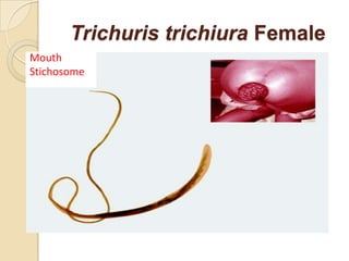 Trichuris trichiura Female
Mouth
Stichosome
 