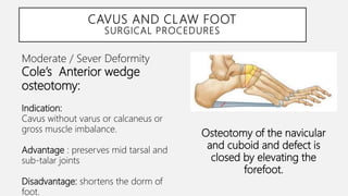 PostPolio Residual Paralysis part2 lower limb | PPTX