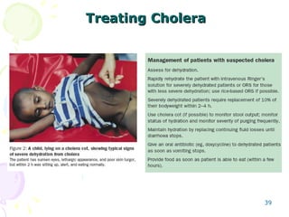 Treating Cholera 
