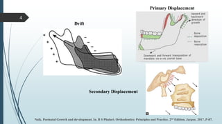 2 PRE NATAL & POST NATAL GROWTH OF THE mandible.pptx